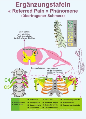 Reflexzonen Ergänzung - « Referred Pain » Phänomene (übertragener Schmerz)